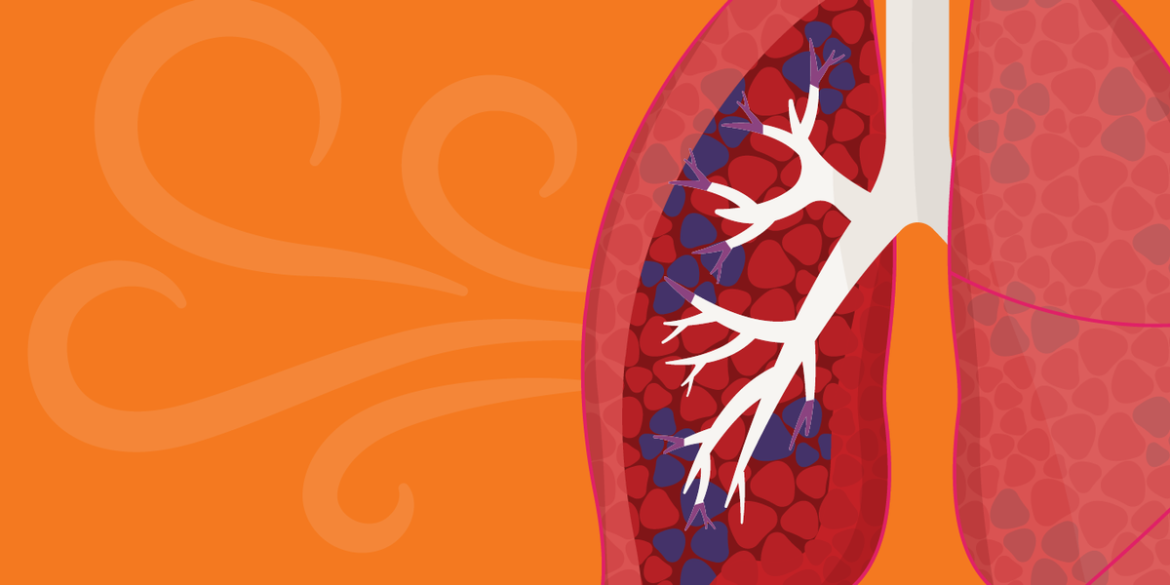 Revolutionary COPD Treatments That Can Change Lives Revolutionary COPD Treatments That Can Change Lives