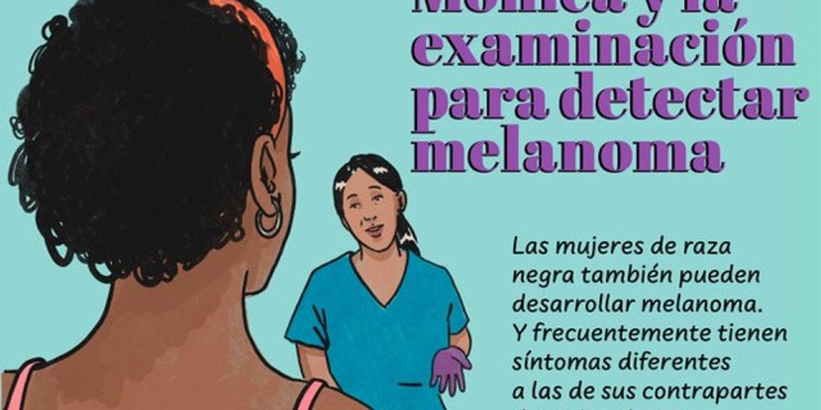 Mónica y la examinación para detectar melanoma Mónica y la examinación para detectar melanoma