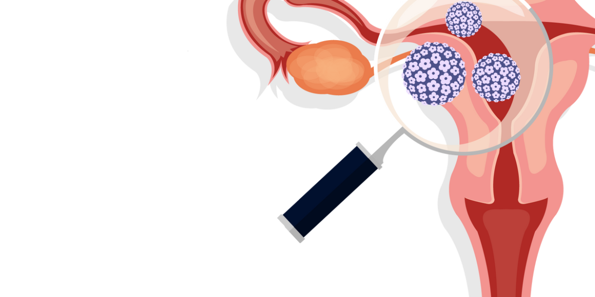 HPV Vaccination Around the World HPV Vaccination Around the World