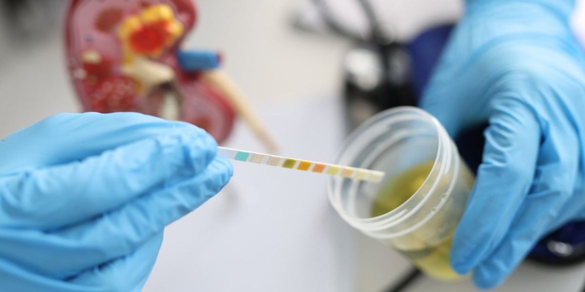 10 Reasons You Might Have Blood in Your Urine 10 Reasons You Might Have Blood in Your Urine