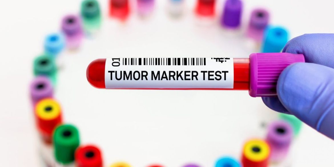 Biomarkers 101 Biomarkers 101