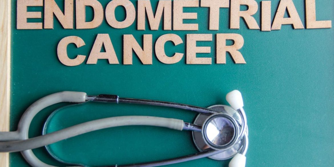 FAQs About FAQs About Endometrial Cancer