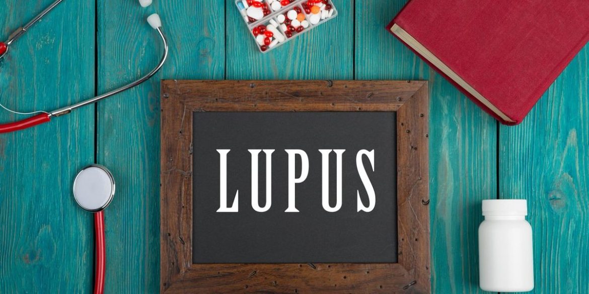 Understanding Lupus Research